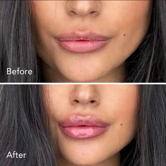 A Complete Guide to Lip Plumper